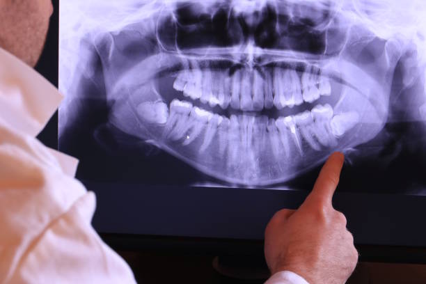 Best Knocked-Out Tooth Emergency  in Goodyear, AZ